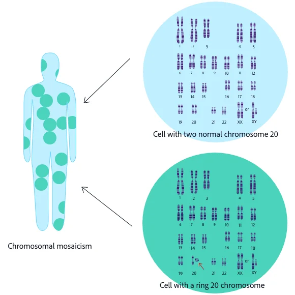 Related HealthJournals - Chromosome Disorders: What Happens When Cell  Division Goes Wrong - StoryMD