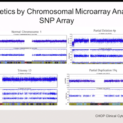 Chromosomal Micro Array